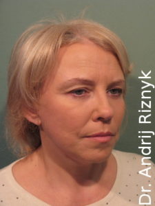 пластика обличчя львів